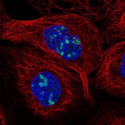 LURAP1L Antibody, Novus Biologicals 25 &mu;L; Unlabeled:Antibodies, Polyclonal